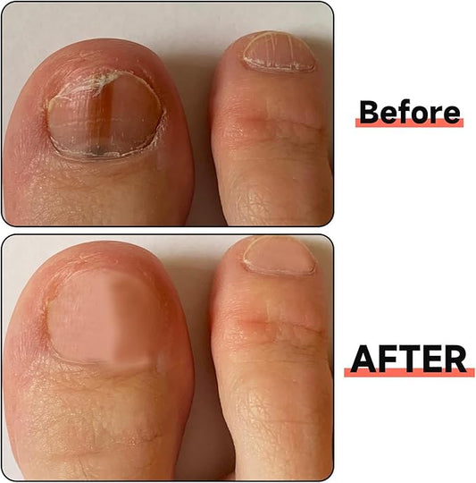 2 Pieces Stainless Steel Nail File for Dogs Women, Ymapinc Toe Nail Files for Thick Nails Professional Finger 4 Sided for Men Seniors & Dogs